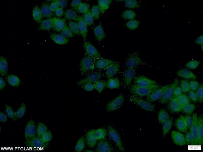 FOLR1 Antibody in Immunocytochemistry (ICC/IF)
