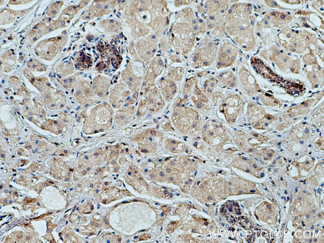 FCHSD1 Antibody in Immunohistochemistry (Paraffin) (IHC (P))