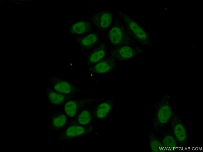 ZCCHC8 Antibody in Immunocytochemistry (ICC/IF)