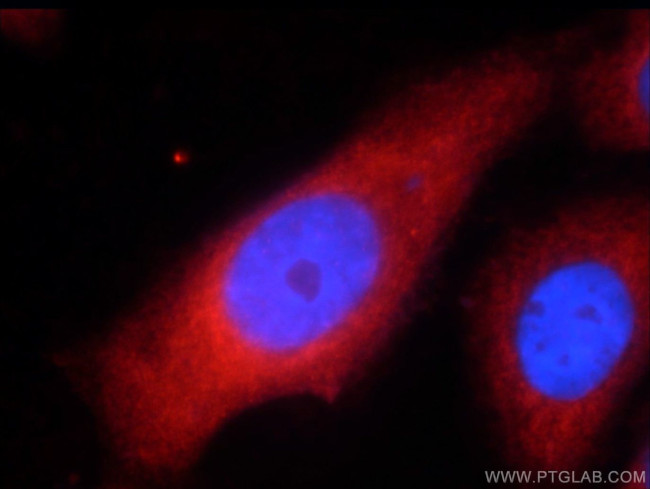 UPF1 Antibody in Immunocytochemistry (ICC/IF)