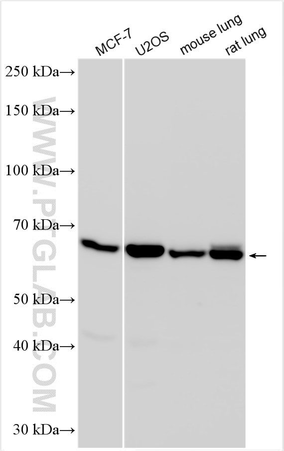 FBXO33 Antibody in Western Blot (WB)