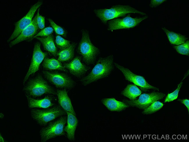 MAN1A1 Antibody in Immunocytochemistry (ICC/IF)