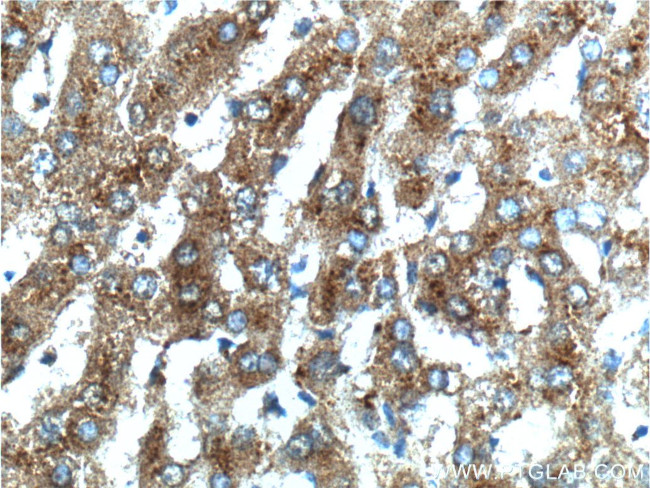 SCD Antibody in Immunohistochemistry (Paraffin) (IHC (P))
