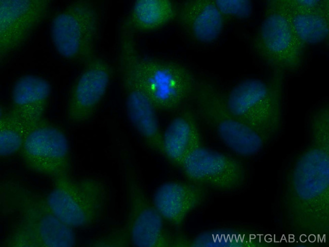 WDR62 Antibody in Immunocytochemistry (ICC/IF)