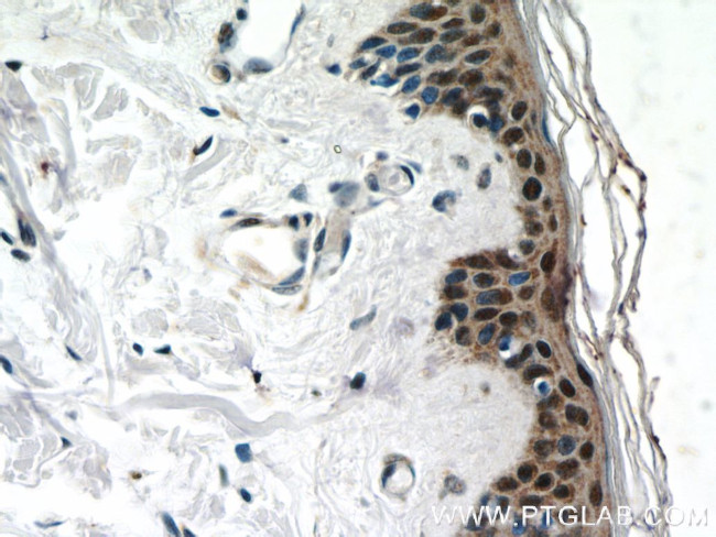 CBX6 Antibody in Immunohistochemistry (Paraffin) (IHC (P))