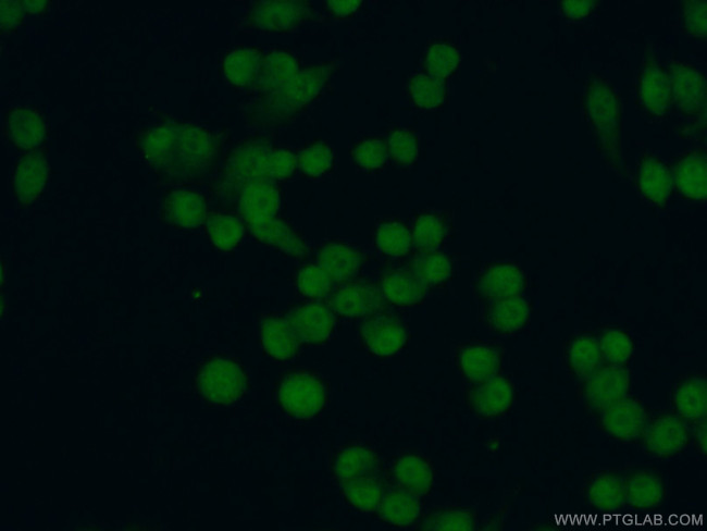 CEBPB Antibody in Immunocytochemistry (ICC/IF)