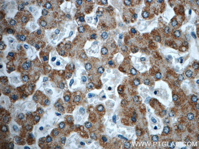 TTC39B Antibody in Immunohistochemistry (Paraffin) (IHC (P))
