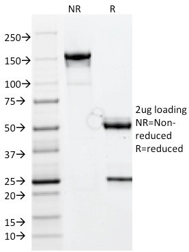 CELA3B/ELA3B (Pancreatic Function Marker) Antibody in SDS-PAGE (SDS-PAGE)