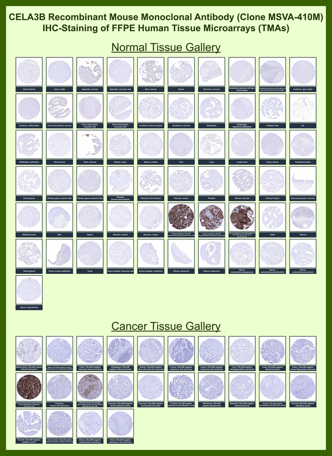 CELA3B/ELA3B (Pancreatic Function Marker) Antibody in Immunohistochemistry (Paraffin) (IHC (P))