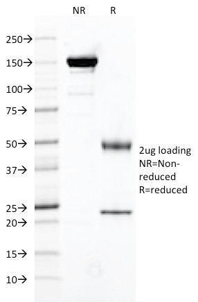 FOLH1/PSMA (Prostate Epithelial Marker) Antibody in SDS-PAGE (SDS-PAGE)