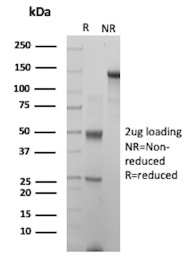 Folate Receptor Alpha (FRalpha)/FOLR1 Antibody in SDS-PAGE (SDS-PAGE)