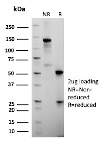 Folate Receptor Alpha (FRalpha)/FOLR1 Antibody in SDS-PAGE (SDS-PAGE)