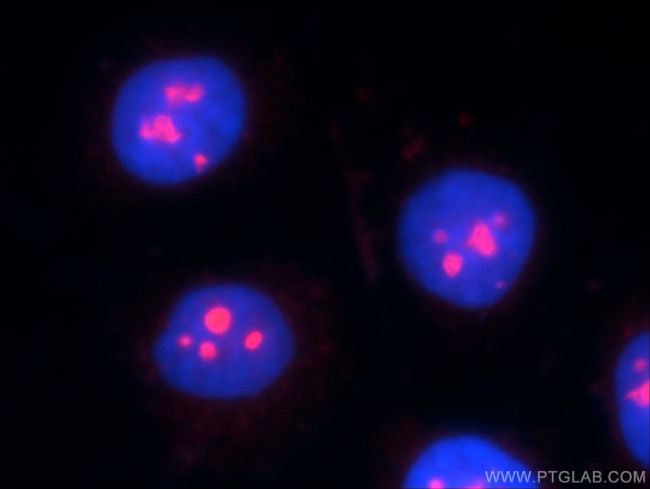 ESF1 Antibody in Immunocytochemistry (ICC/IF)