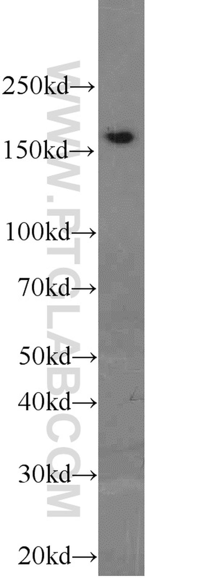 PCF11 Antibody in Western Blot (WB)