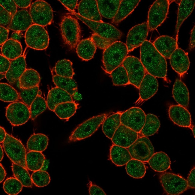 Fos-related antigen 2 (FRA-2)/FOS-like antigen 2 (FOSL2) Antibody in Immunocytochemistry (ICC/IF)