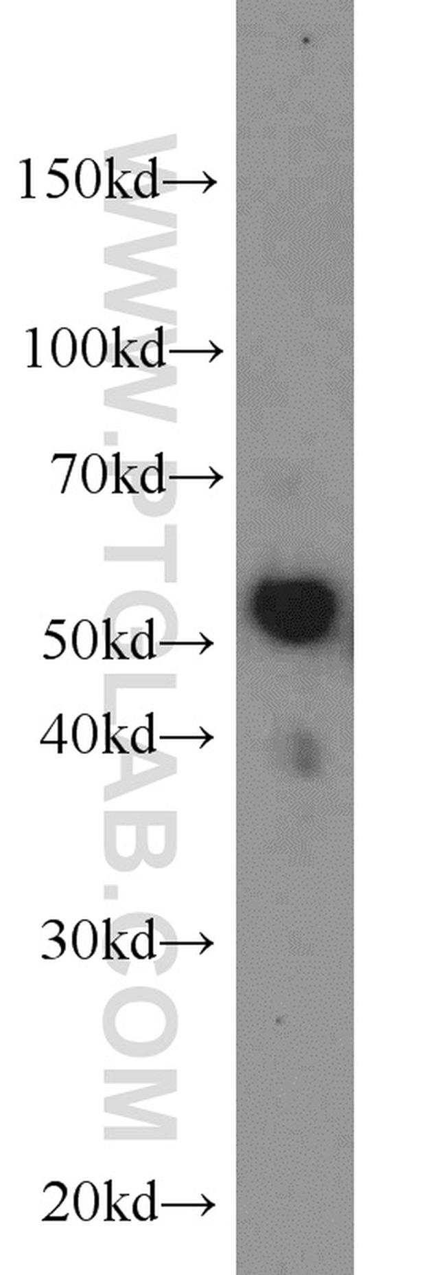 LBP Antibody in Western Blot (WB)