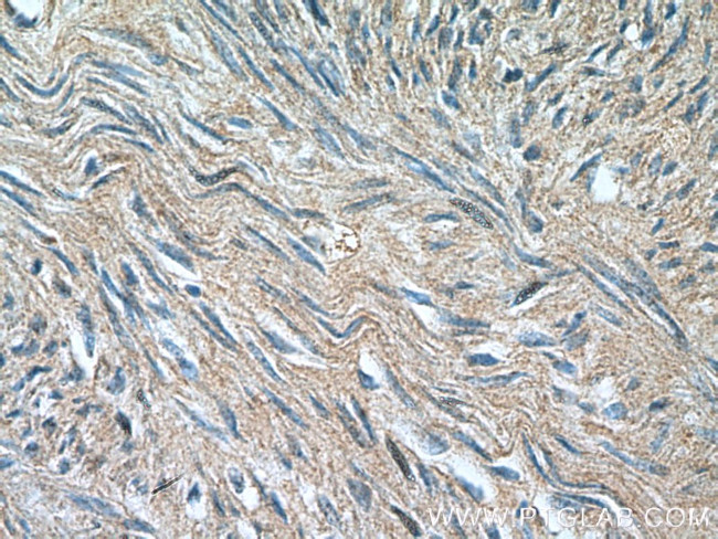 SMTN Antibody in Immunohistochemistry (Paraffin) (IHC (P))