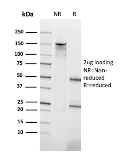 Human Leukemia Antigen (HL-60)/PADI4 (Monocyte Marker) Antibody in SDS-PAGE (SDS-PAGE)