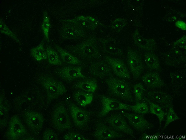 NFKB1 p105 Antibody in Immunocytochemistry (ICC/IF)