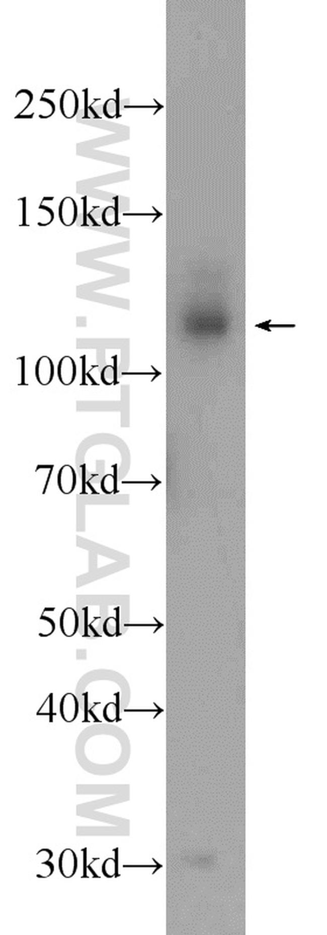DAB2IP Antibody in Western Blot (WB)