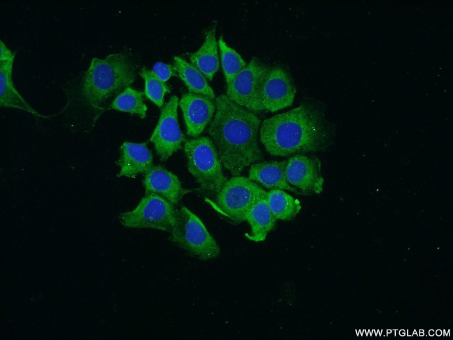 RPS25 Antibody in Immunocytochemistry (ICC/IF)