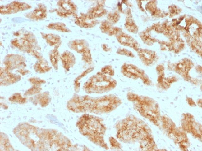 AMACR/p504S (Prostate Cancer Marker) Antibody in Immunohistochemistry (Paraffin) (IHC (P))