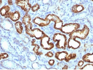 AMACR/p504S (Prostate Cancer Marker) Antibody in Immunohistochemistry (Paraffin) (IHC (P))