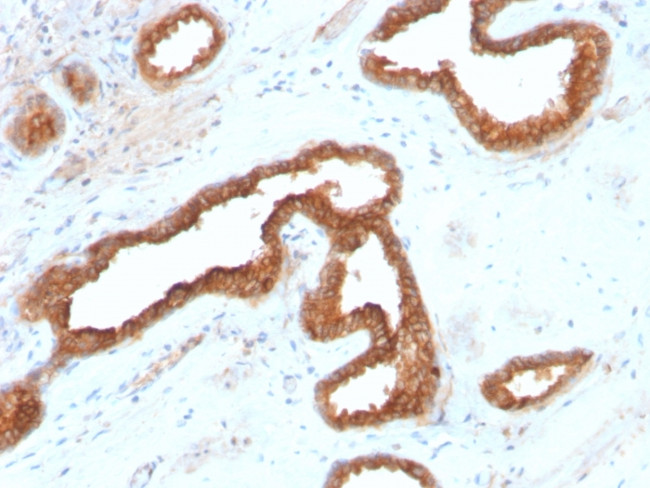 AMACR/p504S Antibody in Immunohistochemistry (Paraffin) (IHC (P))