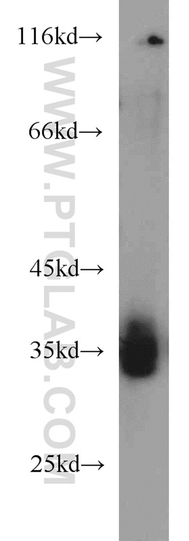TIMMDC1 Antibody in Western Blot (WB)
