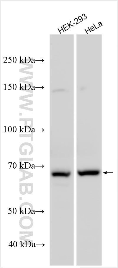 FBXL19 Antibody in Western Blot (WB)