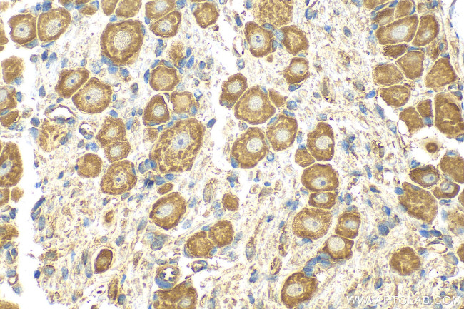 MRGPRD Antibody in Immunohistochemistry (Paraffin) (IHC (P))