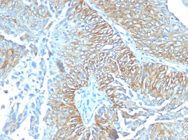 TRIM29 (Lung Squamous Cell Carcinoma Marker) Antibody in Immunohistochemistry (Paraffin) (IHC (P))