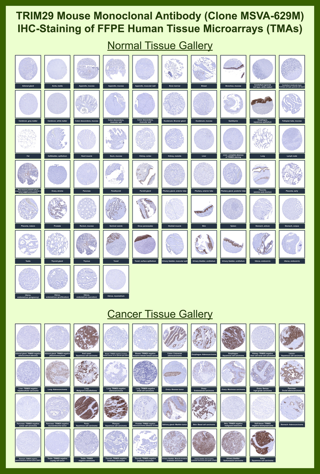 TRIM29 (Lung Squamous Cell Carcinoma Marker) Antibody in Immunohistochemistry (Paraffin) (IHC (P))