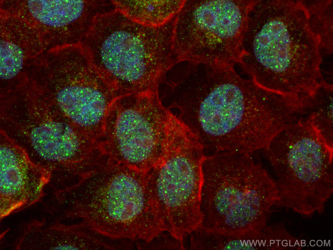 ZNF521 Antibody in Immunocytochemistry (ICC/IF)