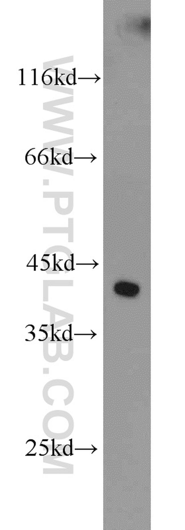 FOXQ1 Antibody in Western Blot (WB)