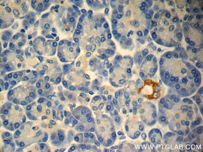 TMEM231 Antibody in Immunohistochemistry (Paraffin) (IHC (P))