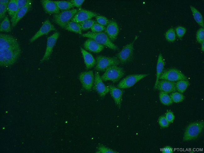 RPAP3 Antibody in Immunocytochemistry (ICC/IF)
