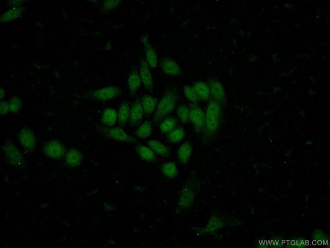 MNT Antibody in Immunocytochemistry (ICC/IF)