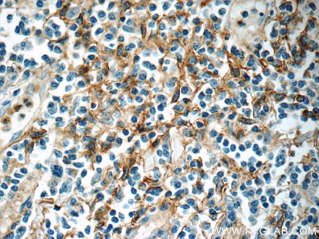 ENOX1 Antibody in Immunohistochemistry (Paraffin) (IHC (P))