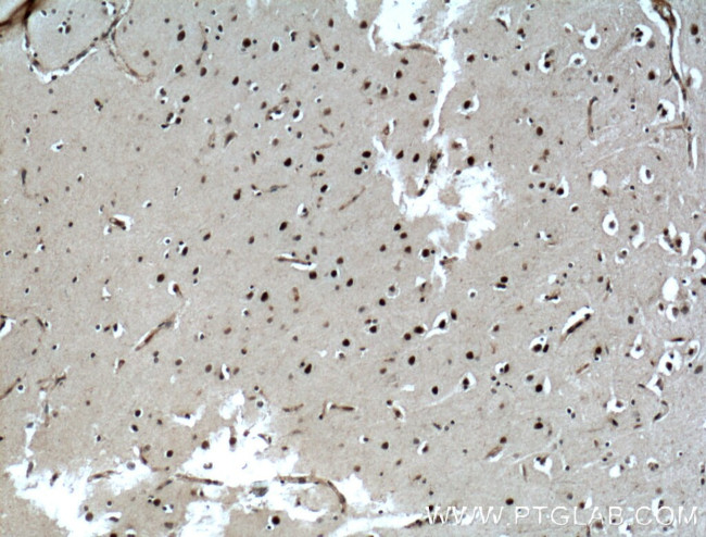 ASCL1 Antibody in Immunohistochemistry (Paraffin) (IHC (P))