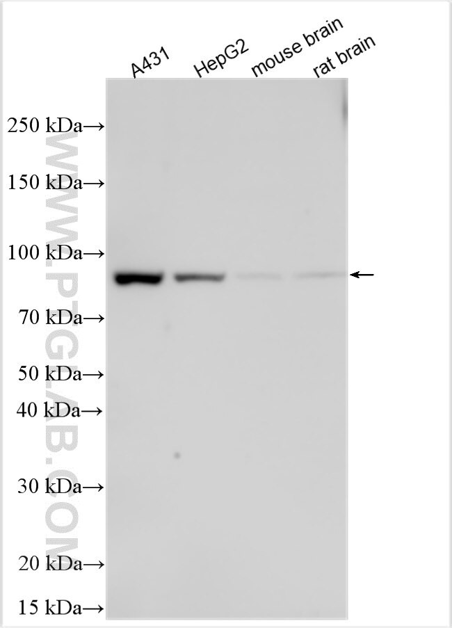 UGT1A6 Antibody in Western Blot (WB)