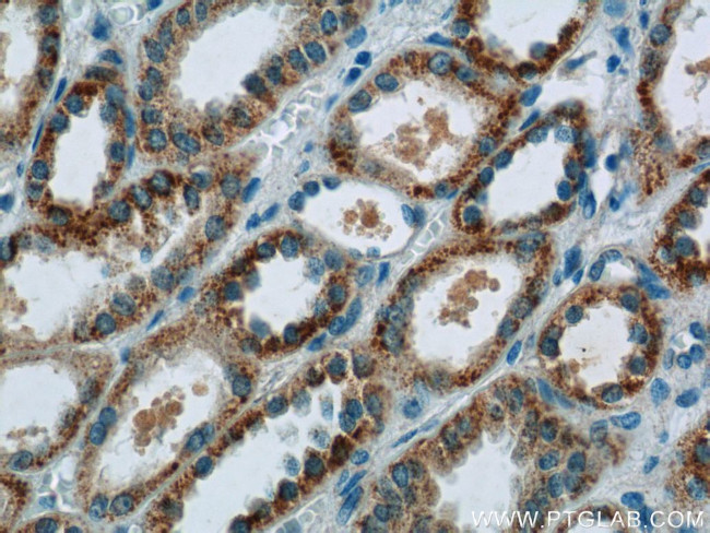 CCDC27 Antibody in Immunohistochemistry (Paraffin) (IHC (P))