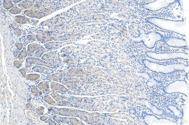 ADM2 Antibody in Immunohistochemistry (Paraffin) (IHC (P))