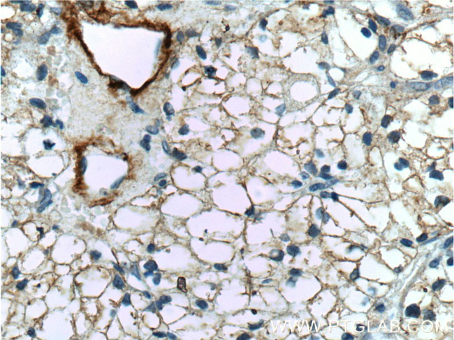 MME/CD10 Antibody in Immunohistochemistry (Paraffin) (IHC (P))