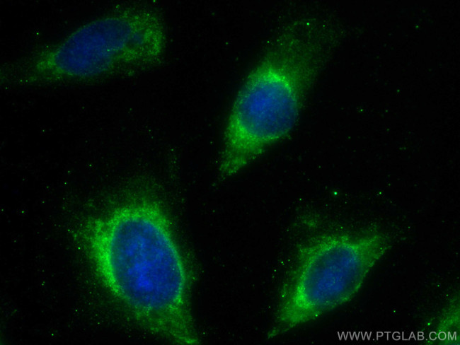 PRELP Antibody in Immunocytochemistry (ICC/IF)
