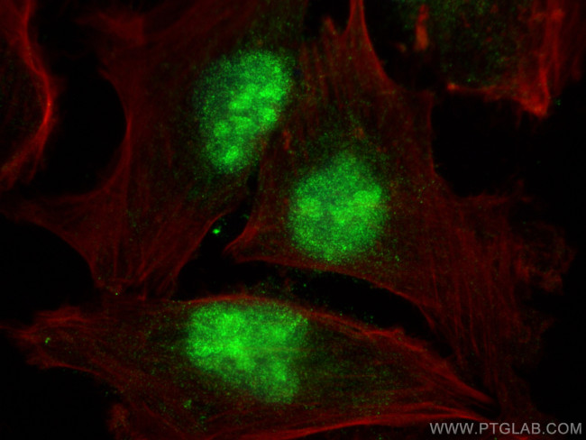 PTPRU Antibody in Immunocytochemistry (ICC/IF)