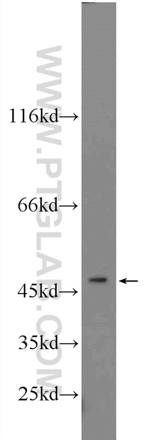 ZNF271 Antibody in Western Blot (WB)