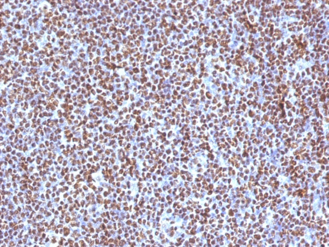 ALK (Anaplastic Lymphoma Kinase)/CD246 Antibody in Immunohistochemistry (Paraffin) (IHC (P))
