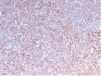 ALK (Anaplastic Lymphoma Kinase)/CD246 Antibody in Immunohistochemistry (Paraffin) (IHC (P))