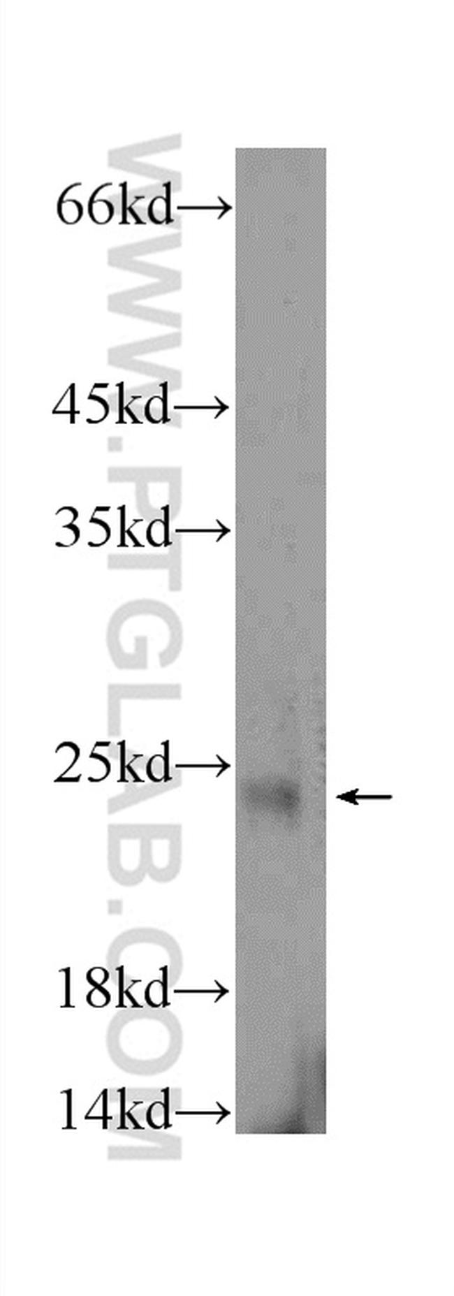 FATE1 Antibody in Western Blot (WB)